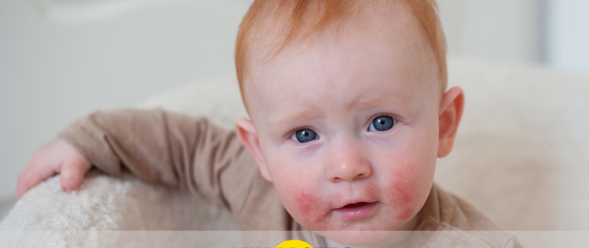 Dermatite atópica em bebés devido à humidade